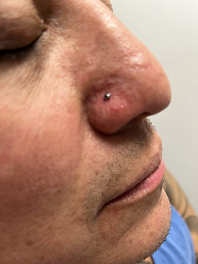 Nose Piercing In Palm Coast