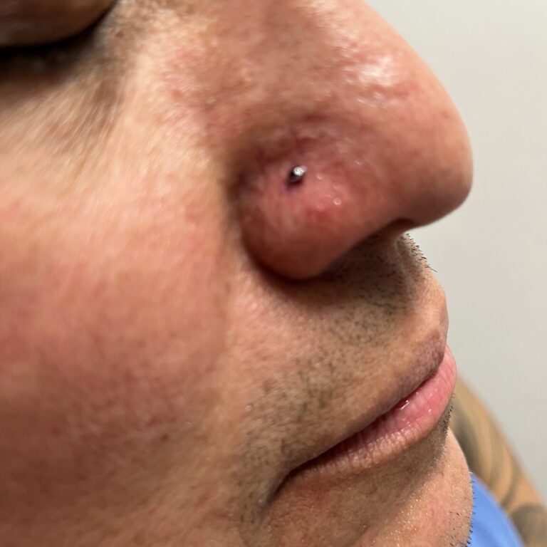 Just Pierced Nostril Nose Piercing In Palm Coast